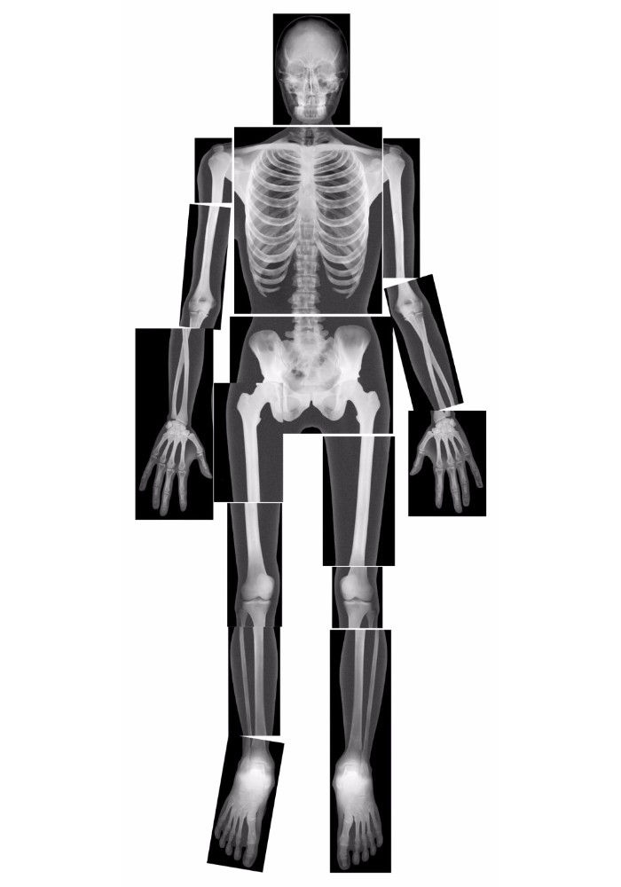 082176 True To Life Human X-rays - Set - 18