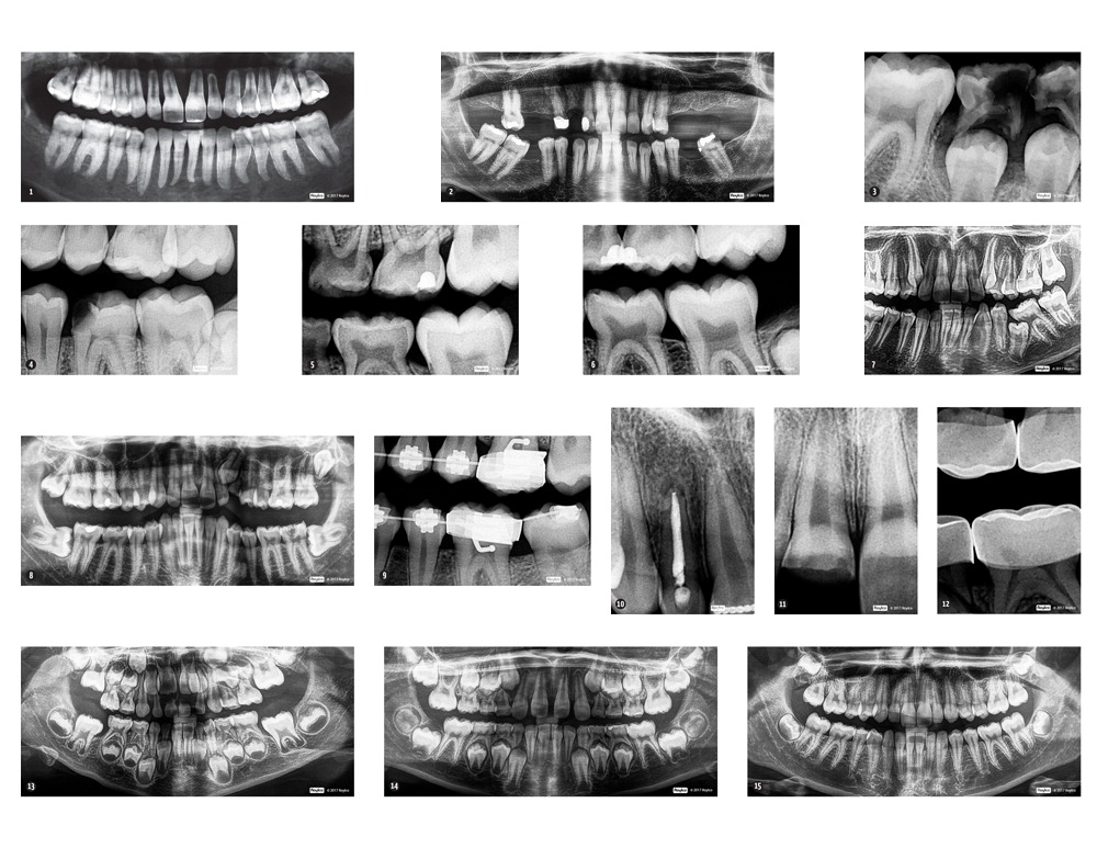 1604141 Dental X Rays