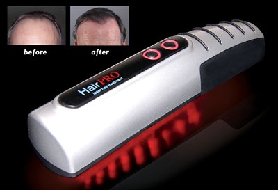 Laser Hair Brush - Viatek LB01G Hair Pro Laser Hair Brush