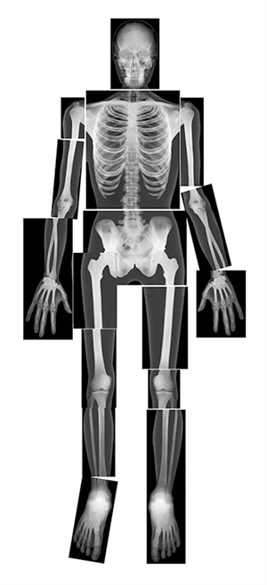 Roylco Inc. R-5911 True To Life Human X-rays