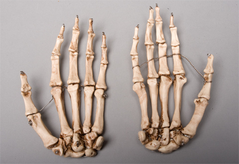 Sm376dla Aged Left Skeleton Hand