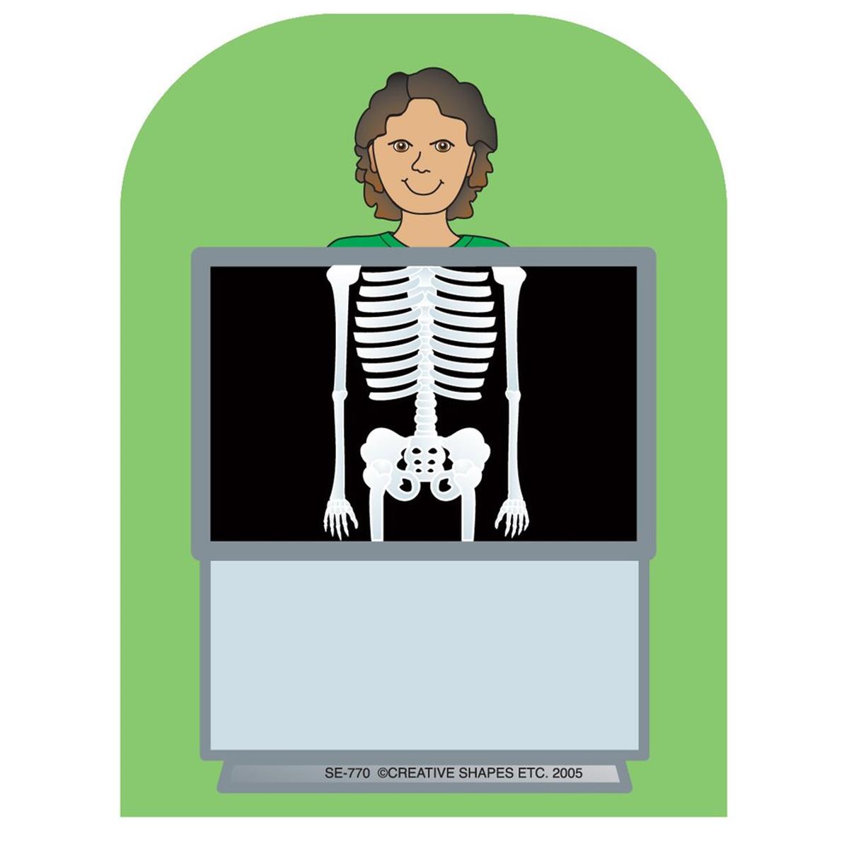 SE-0770 4.5 x 4 in. Mini Notepad, X-Ray - 35 Sheets per Pack