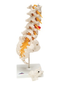 Picture of Fabrication Enterprises 12-4543 Anatomical Model Lumbar Spinal Column with Dorso-Lateral Prolapsed Disc