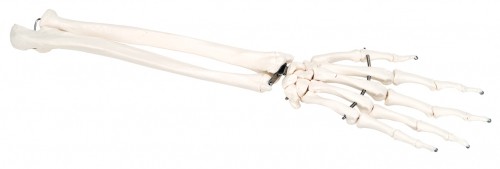 Picture of Fabrication Enterprises 12-4581L Anatomical Model Loose Bones, Hand Skeleton with Ulna & Radius