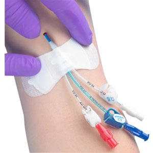 Picture of TIDI Products ZEF3300MWA 0.25 - 0.50 in. Securement Device for Universal Picc Catheter