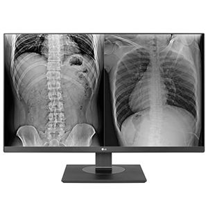 Picture of LG 27HJ713C-B Clinical HDMI PVT FDA Class I LCD Monitor, Large