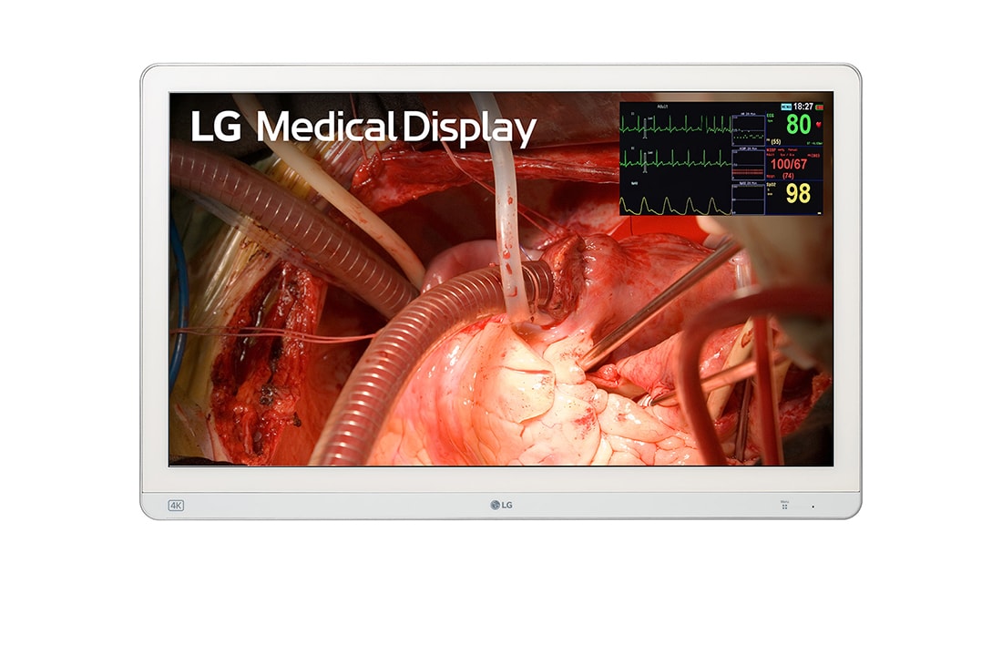 Picture of LG 27HQ710S-W 27 in. 4K Surgical Monitor with Mini-LED