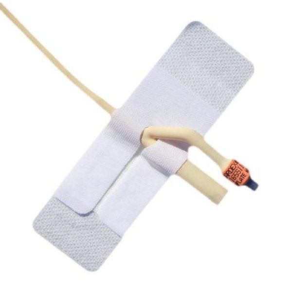 Picture of Pepper Medical 1062031-EA Catheter Foley with Adhesive - Box of 50