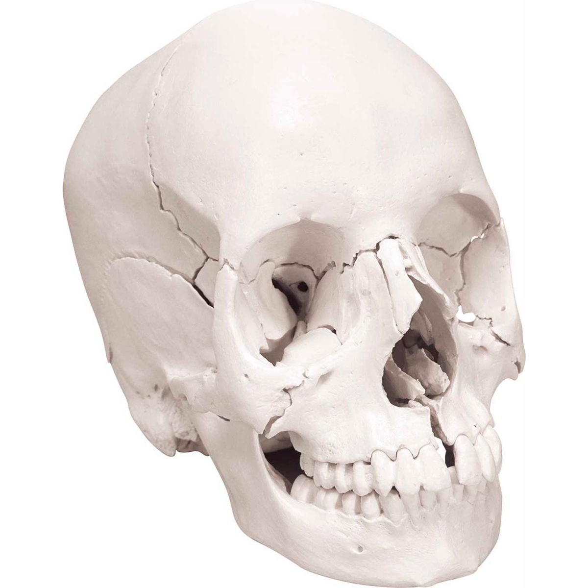 B2138024 3B Anatomical Model - 22-Part Beauchene Anatomical Skull