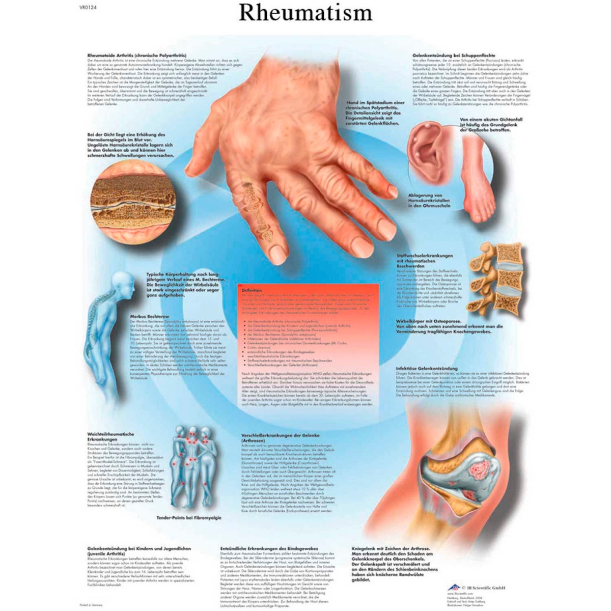 B2138019 3B Anatomical Chart - Rheumatic Diseases, Paper