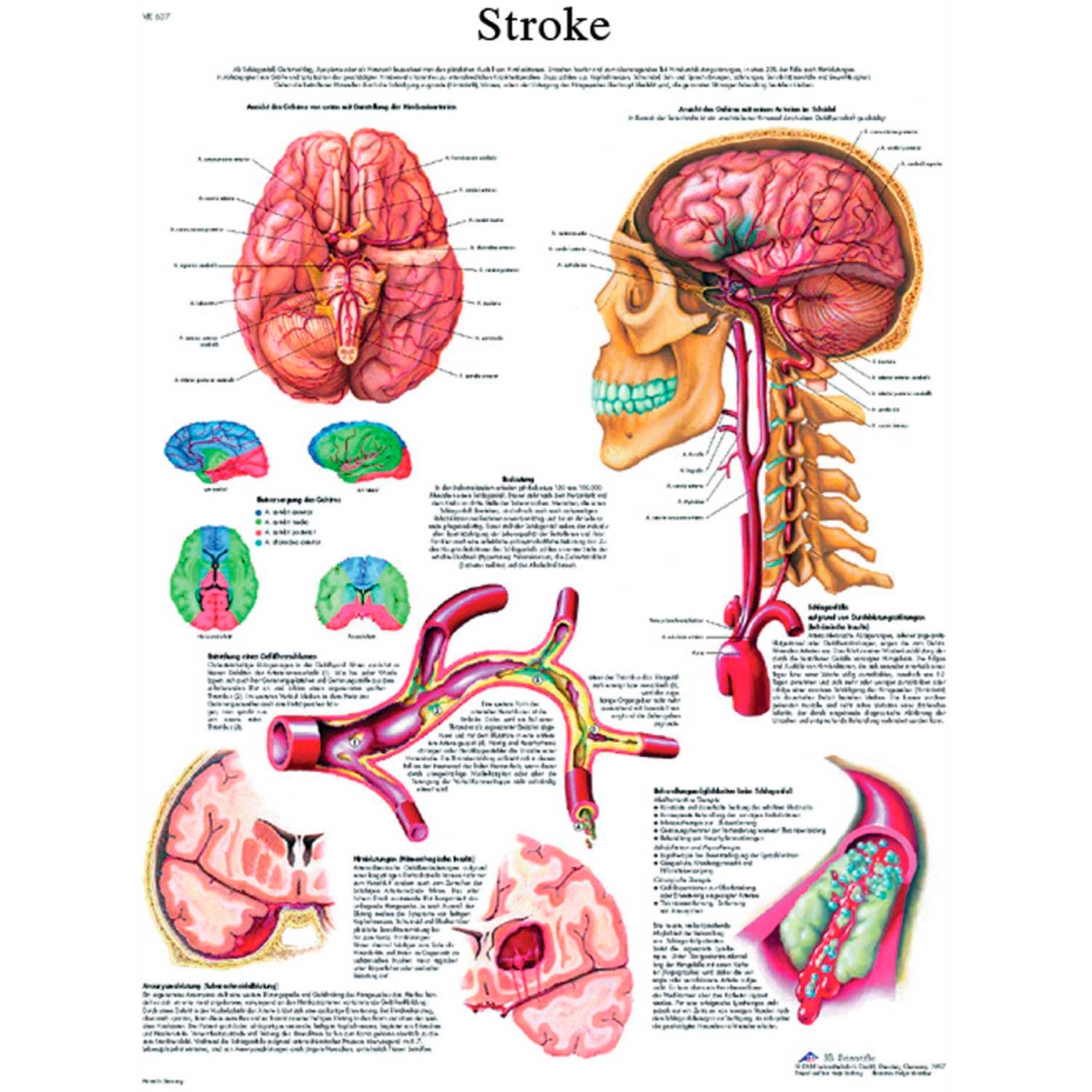 B2138092 3B Anatomical Stroke Paper Chart