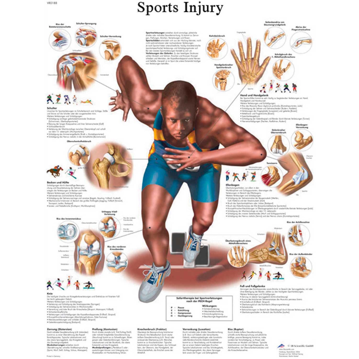 B2138081 3B Anatomical Chart - Sports Injuries, Sticky Back