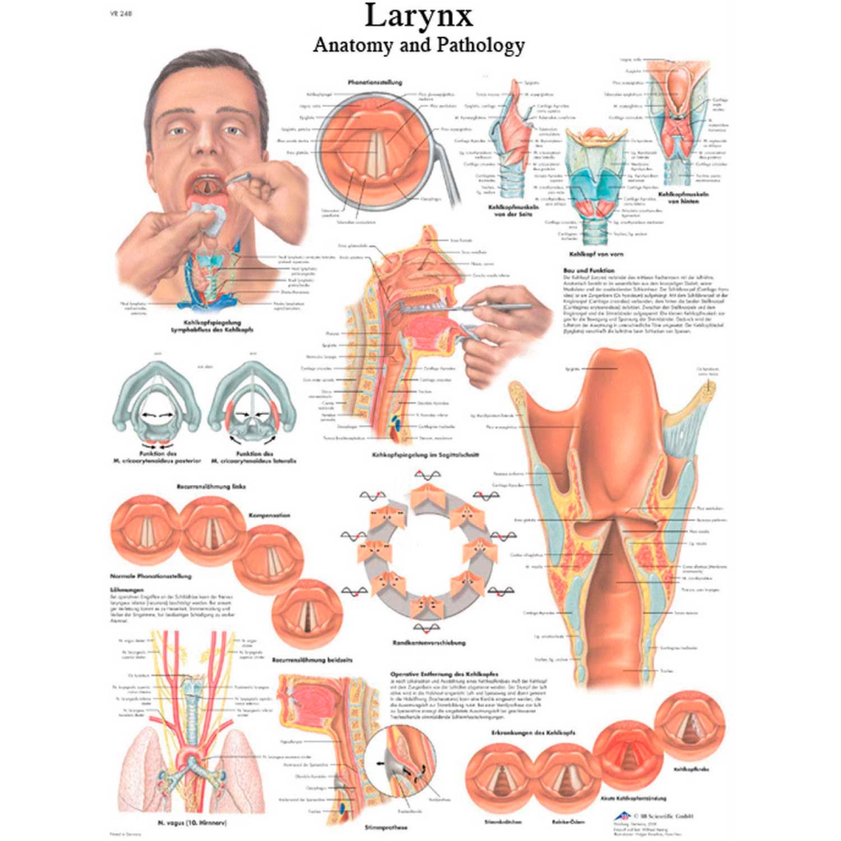 B2137995 3B Anatomical Chart - Larynx, Paper