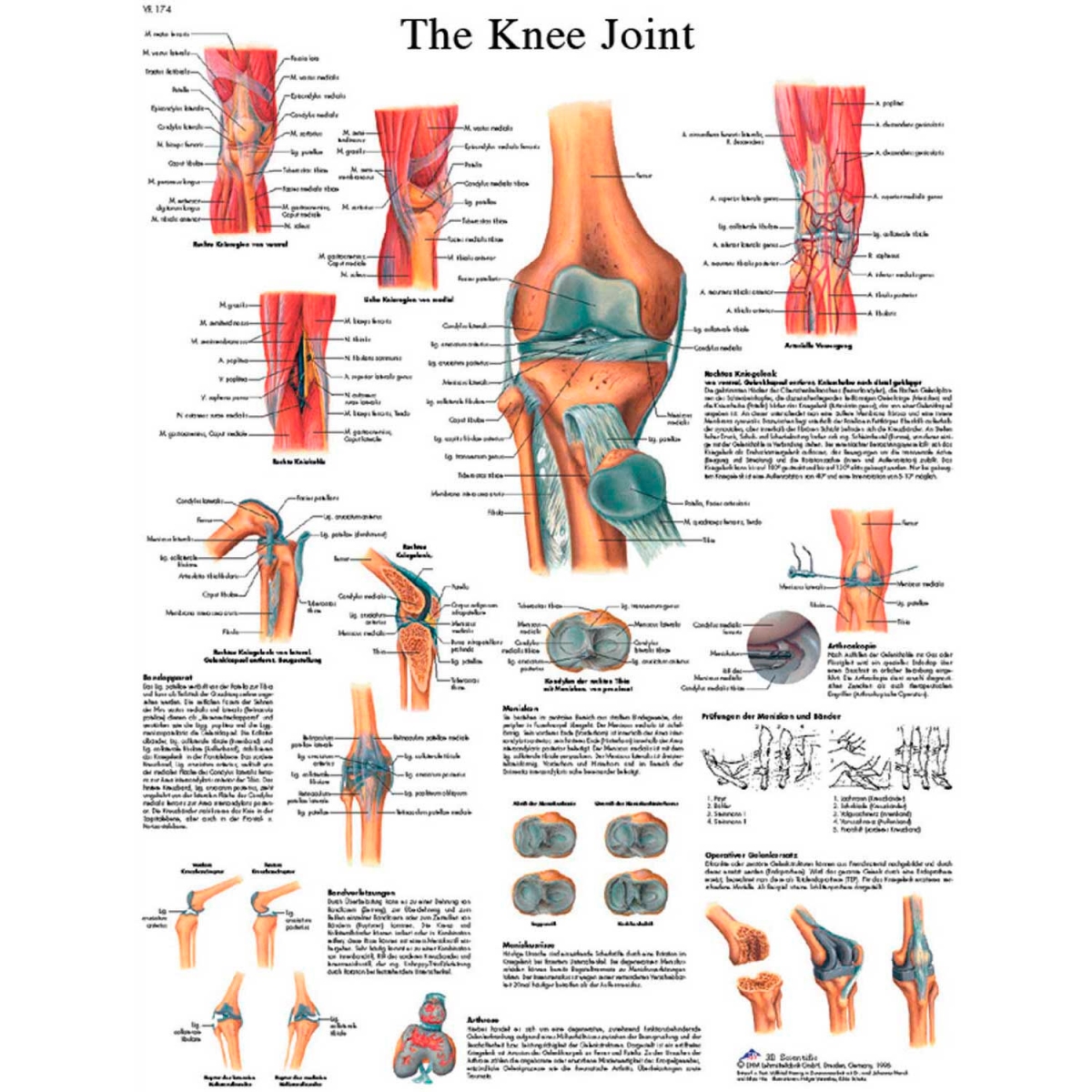 B2137986 3B Anatomical Chart - Knee Joint, Sticky Back