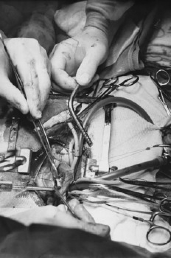 Close-Up of Surgeons Performing Open-Heart Surgery Poster Print