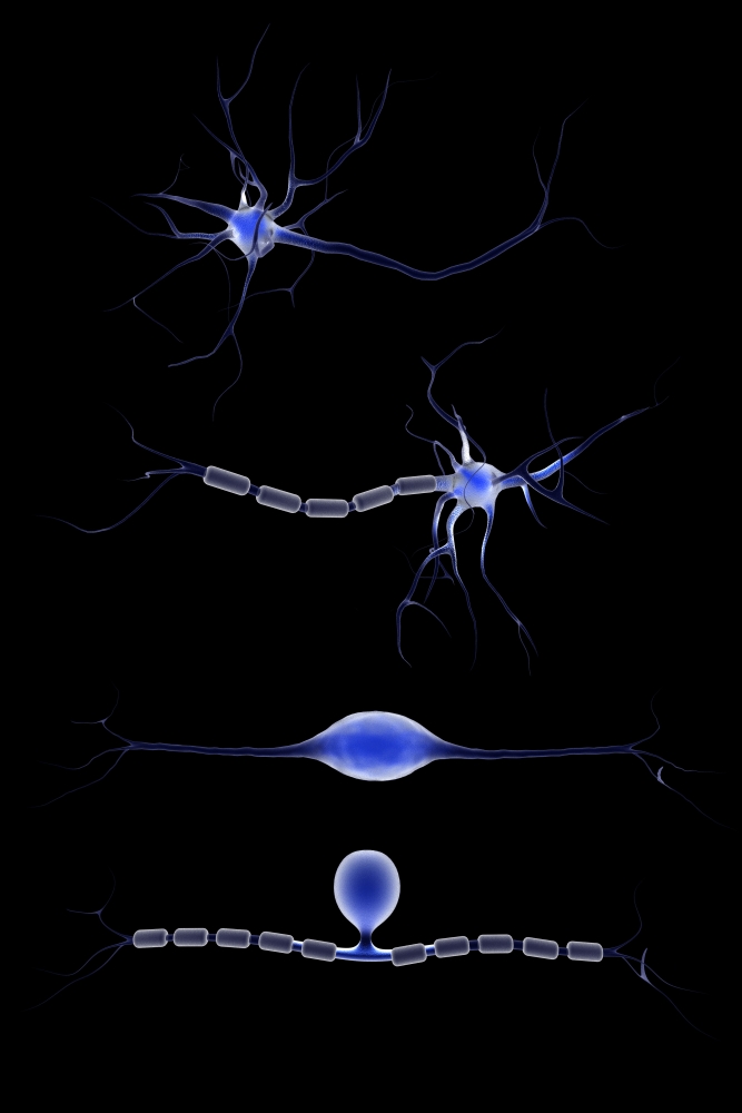 Conceptual Image of A Neuron Poster Print, 11 x 17