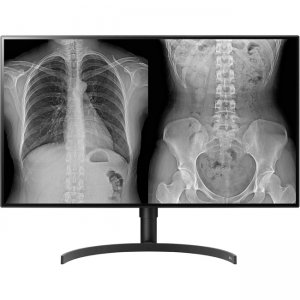 Picture of LG 32HL512D-B 32 in. Medical IPS 8MP Diagnostic Monitor - 3840 x 2160 Display Port FDA 510K Class II