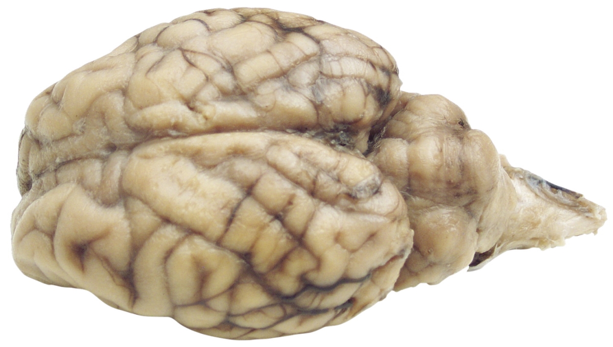 Picture of Frey Scientific 596877 Choice Plain Injected Preserved Sheep Organ Brain without Hypo