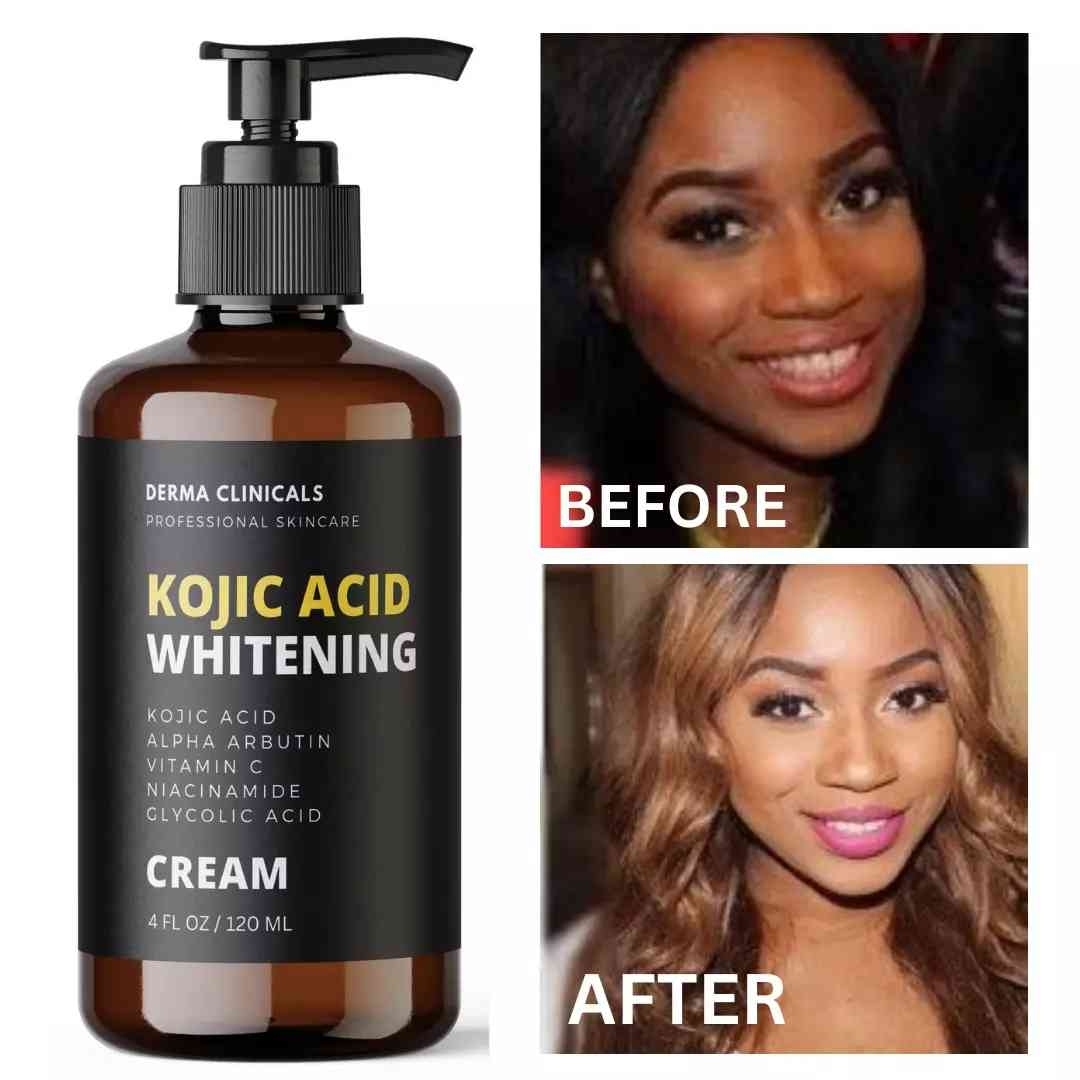 AV99255 Dark Skin Whitening Dark spot Brightening Bleaching Lightening Face body Cream -  Derma Clinicals