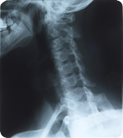 Picture of Medlink Imaging MLI1381012 RADIOMAT Medical X-Ray Film 10 Inch x 12 Inch 100 per box